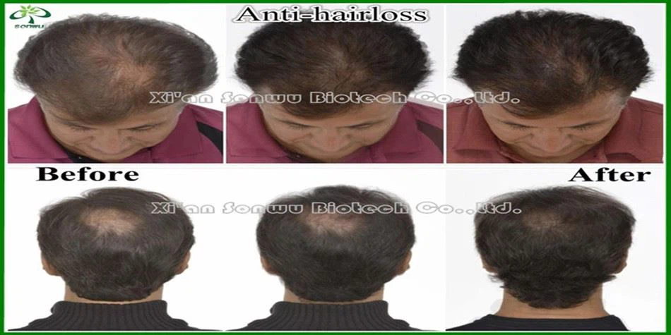 Anti-hair_