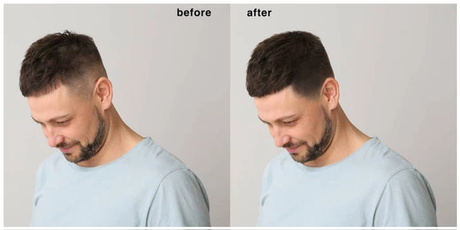 Pure finasteride powder effect