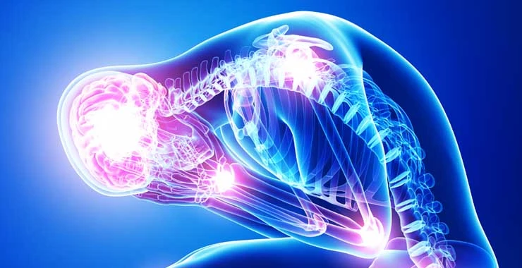 body-stress-title-imagetcm7-230134 body-stress-title-imagetcm7-230134