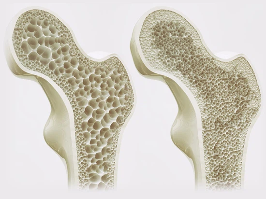 Testolone 2 Testolone 2