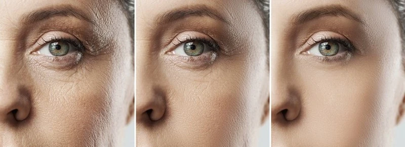 DAC Potential anti-aging effects DAC Potential anti-aging effects