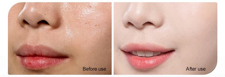 Gentler Whitening Gentler Whitening