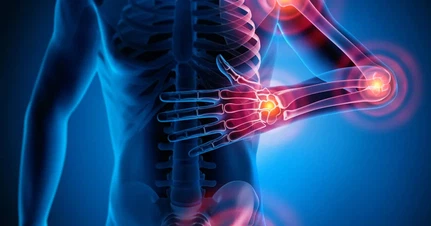 Can Nopipeptide reduce inflammation Can Nopipeptide reduce inflammation