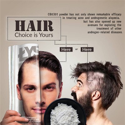 Why Do I Get Acne On My Scalp? Experts Explain Scalp Acne And Dandruff