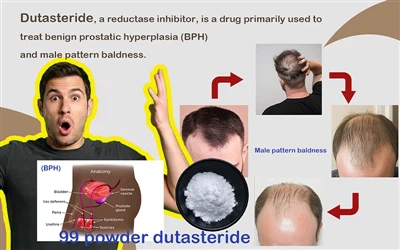 From Scalp To Hormones: How Modern Medicine Effectively Combats Male Hair Loss
