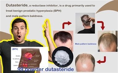 From Scalp To Hormones: How Modern Medicine Effectively Combats Male Hair Loss