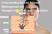 Understanding The Link Between Melanogenesis And Changes in Skin Tone And Pig...