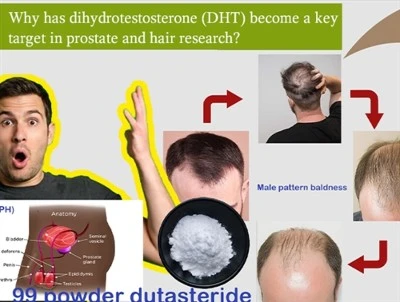 Why Has DHT Become A Key Target in Prostate And Hair Research