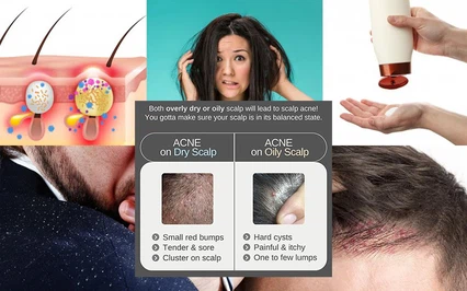 76CB0301 powder 76CB0301 powder