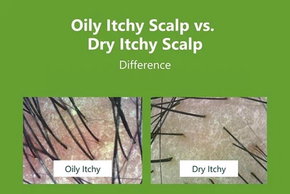 76CB0301 powder B 76CB0301 powder B