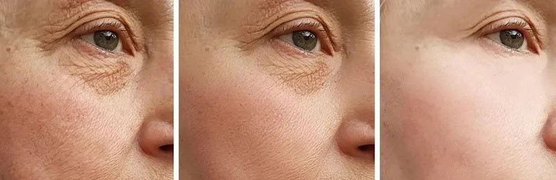 Palmitoyl Tripeptide-5 Firm and anti-wrinkle